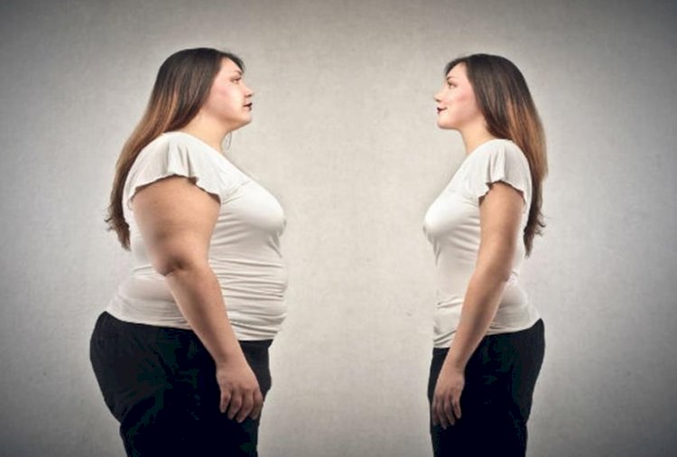 هشاشة العظام تصيب المراهقين الذين تعرضوا لعمليات جراحية من أجل أنقاص الوزن