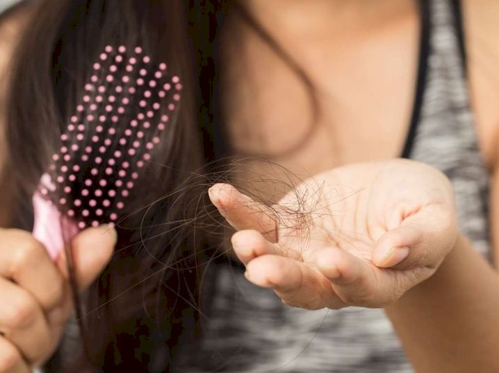 دكتور يكشف حقيقة الصلع الوراثى بين السيدات