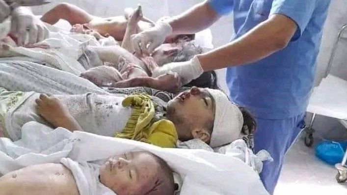 الشهداء والجرحي يتساقطون في غزة والعالم لايري