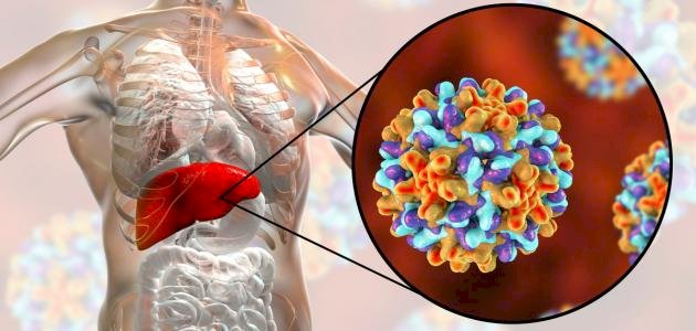 تقرير عالمي يحذر من الالتهاب الكبدي الوبائي .. 6 آلاف يصابون يوميا