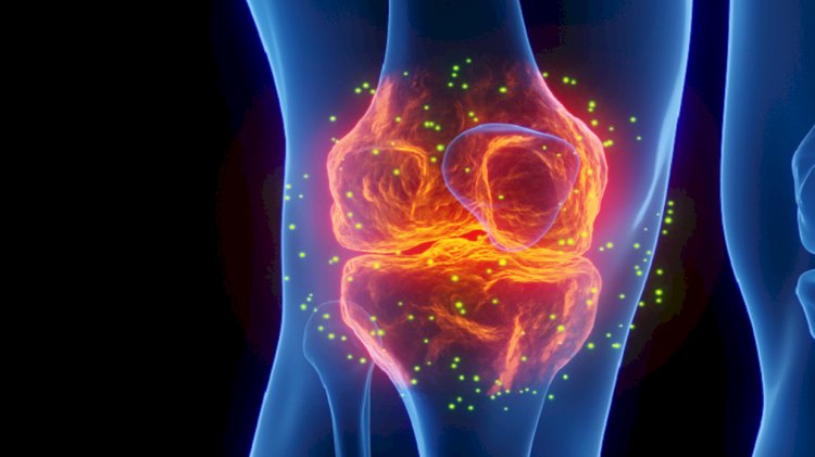 7 نصائح هامة تقيك من هشاشة العظام وتجنبك الألم الشديد