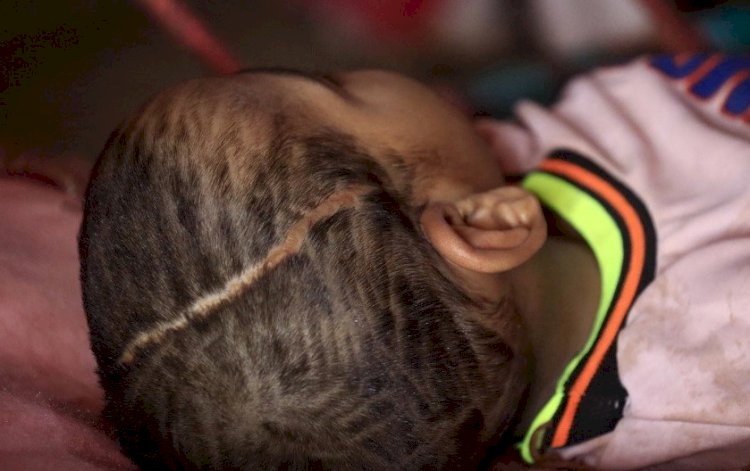 لاتقفوا مكتوفي الأيدي .. أنقذوا السودان من تفشي وباء الكوليرا