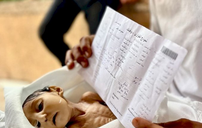 اغتيال البراءة بالمجاعة.. غدير طفلة 5 سنوات شهيدة بسبب سوء التغذية