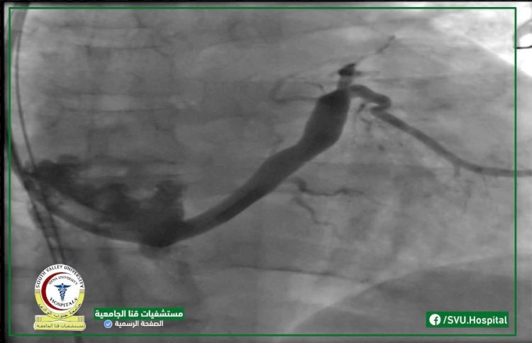 إنجاز طبي جديد تحقق بوحدة كهروفسيولوجيا القلب بمستشفيات قنا الجامعية.