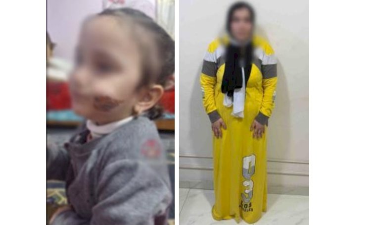 ضبط الام المتهمة باصابة ابنتها بحروق بكفر الشيخ