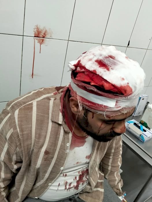 العناية الألهية تنقذ شاب من الموت سقط عليه سور أثناء هدمه جنوب بني سويف