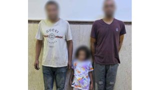 نكشف منشور وجود طفلة يظهر عليها آثار تورم بالعينين مع أحد الأشخاص بالإسكندرية
